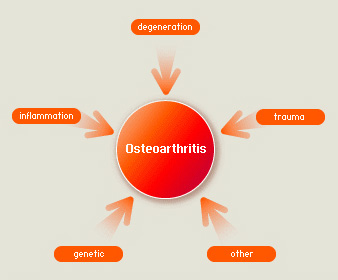Causes of Osteoarthritis
